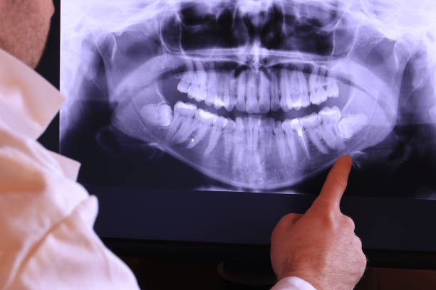 Urgent Tooth Repair in IA